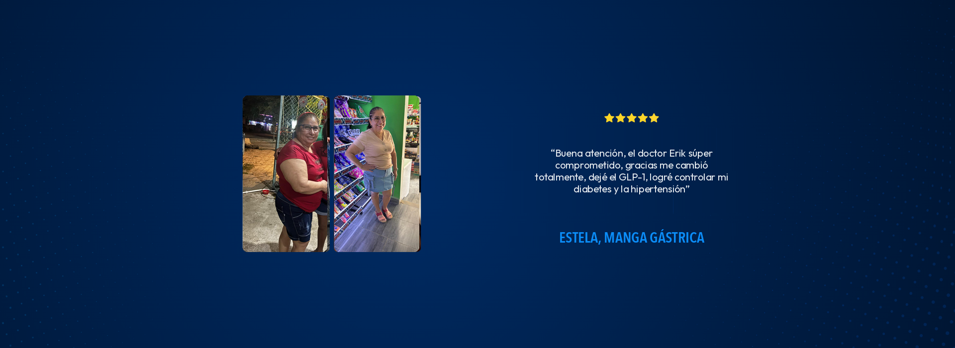 Estela, Manga Gástrica